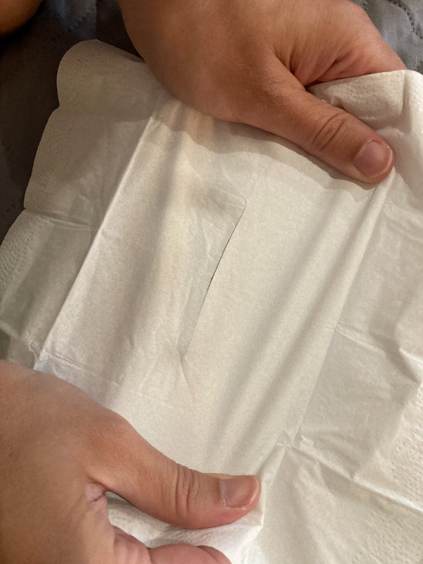 A picture of the same tissue with a slit. This time, hands are pulling at the edges of a tissue, stretching it in the same direction as the slit. This shows the opening being closed.